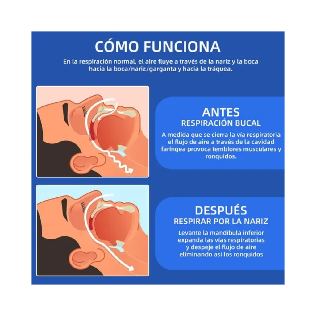 Protección Dental Antirronquidos